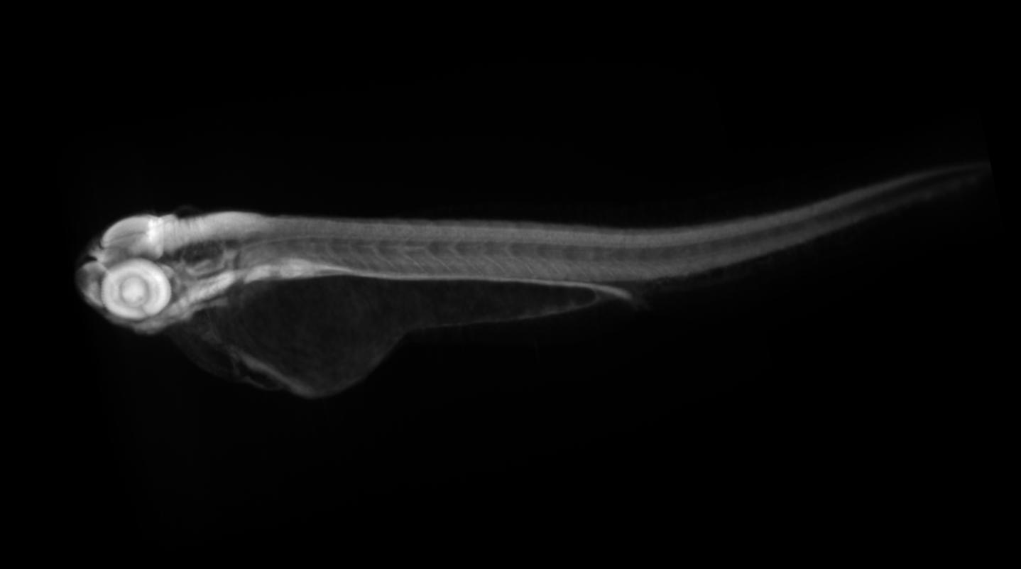 zebrafish 72hrs side view